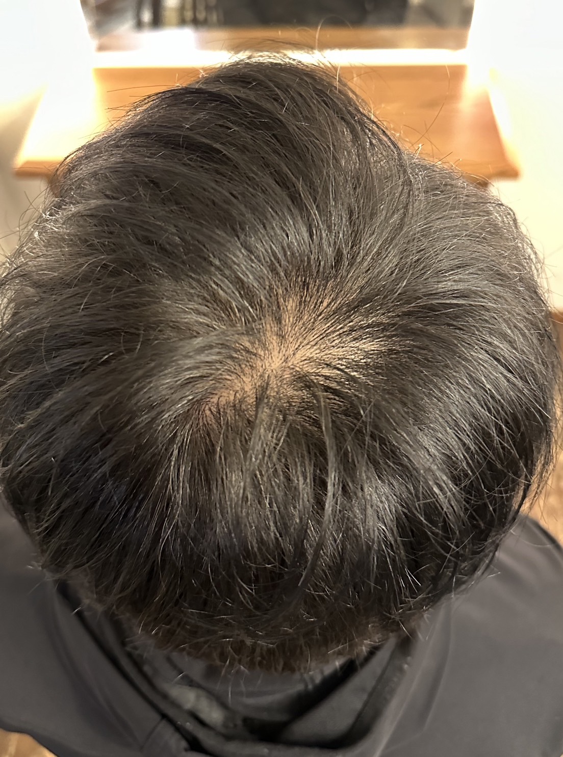 エクソソームPJ