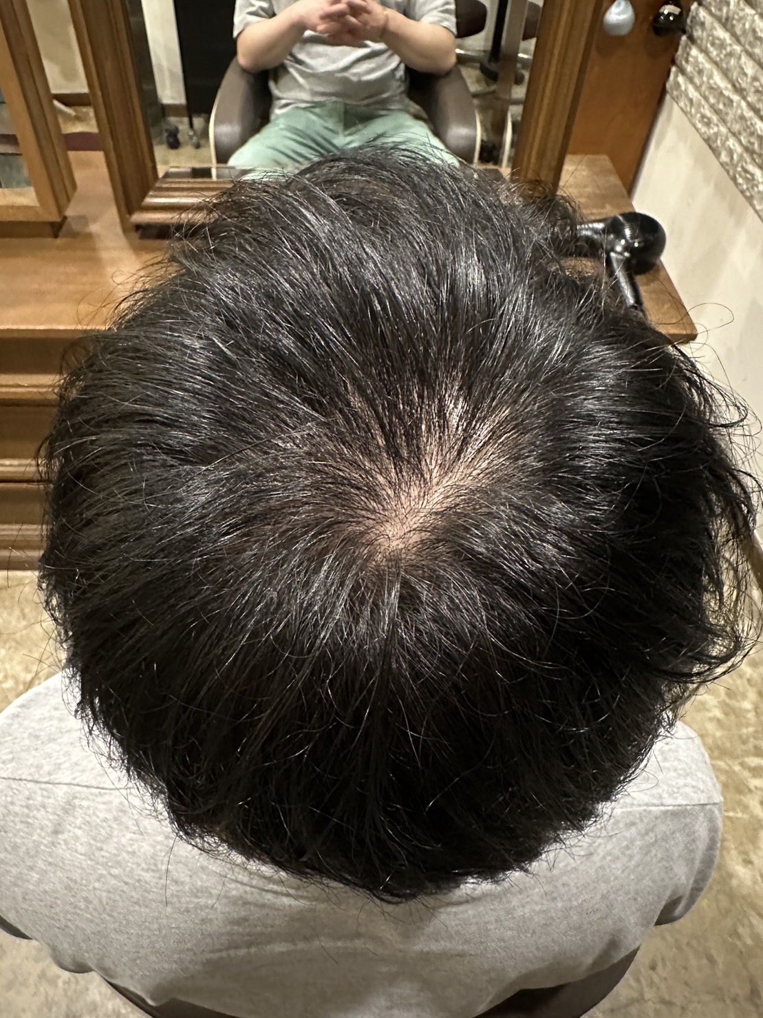 エクソソームPJ