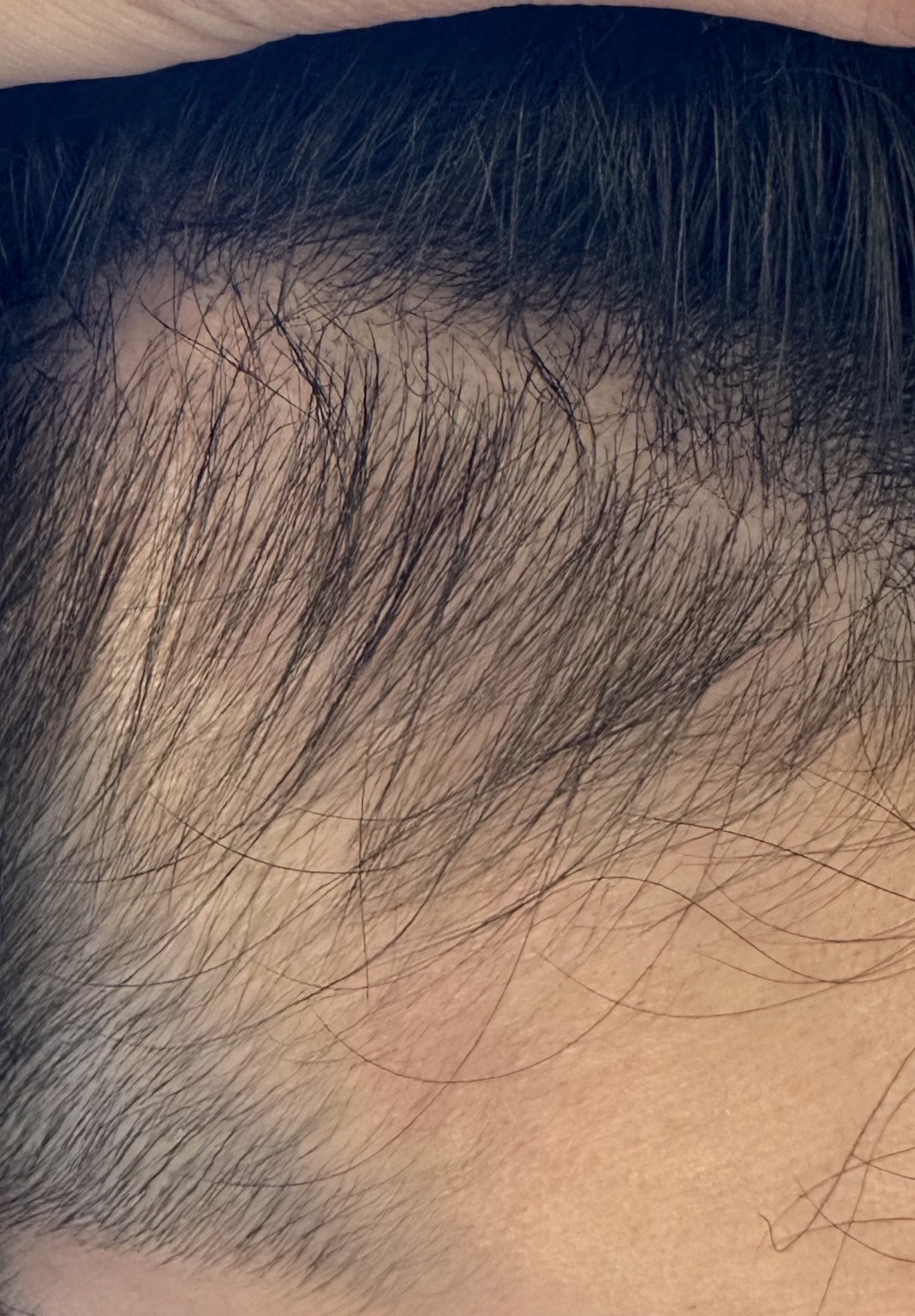 エクソソームPJ