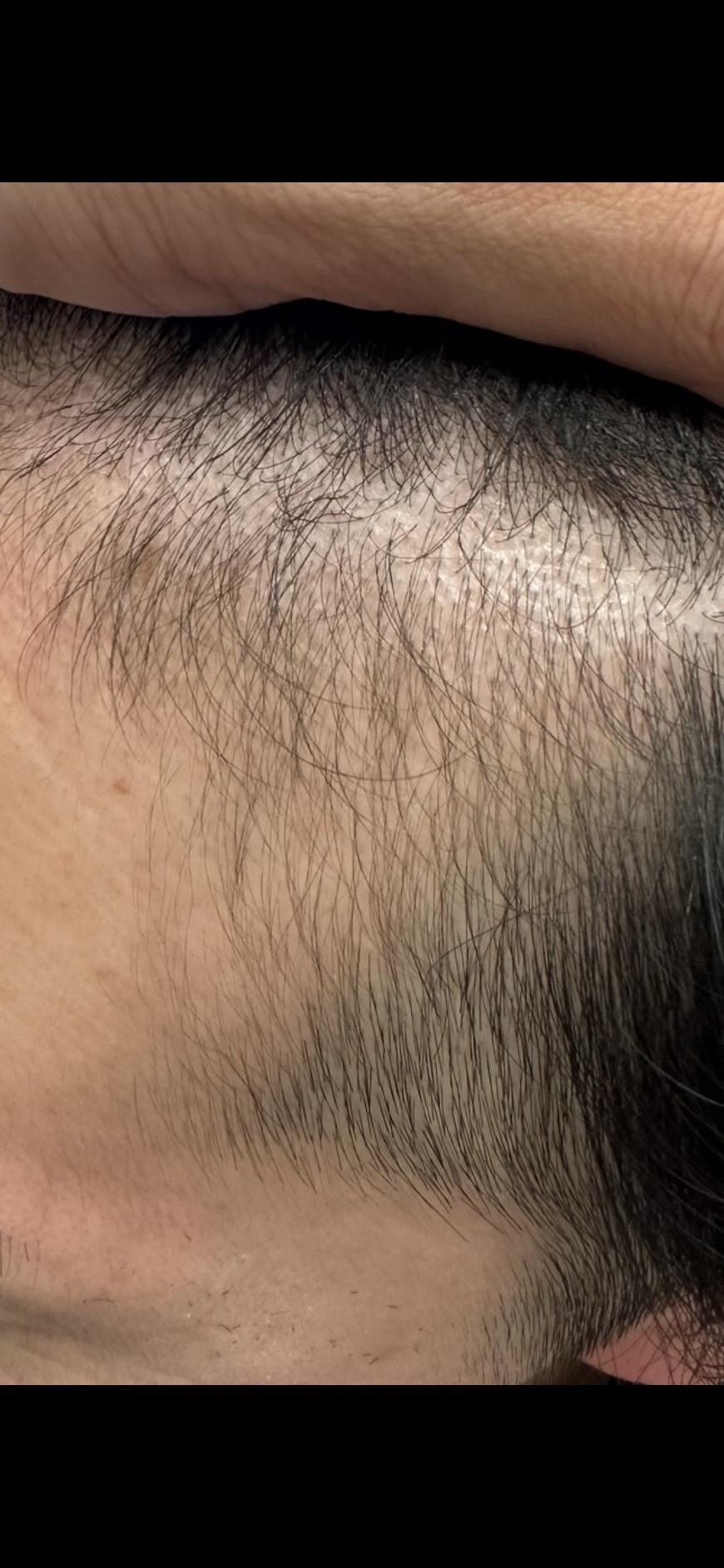 エクソソームPJ