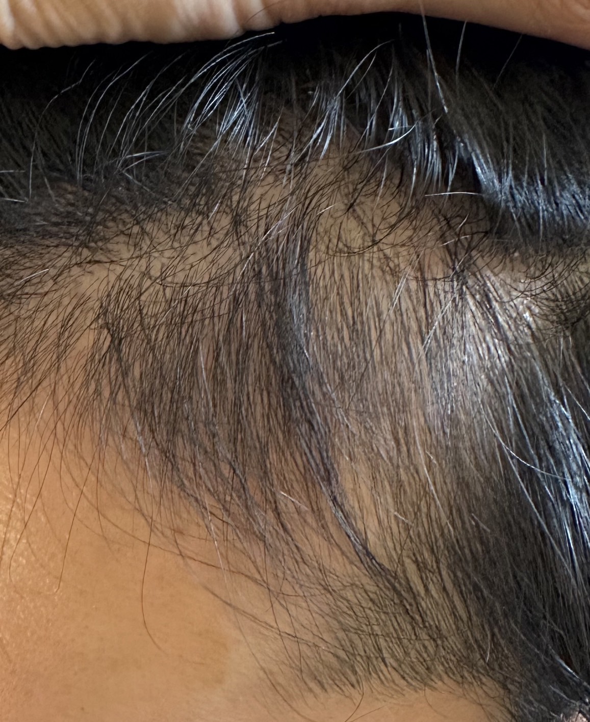 エクソソームPJ