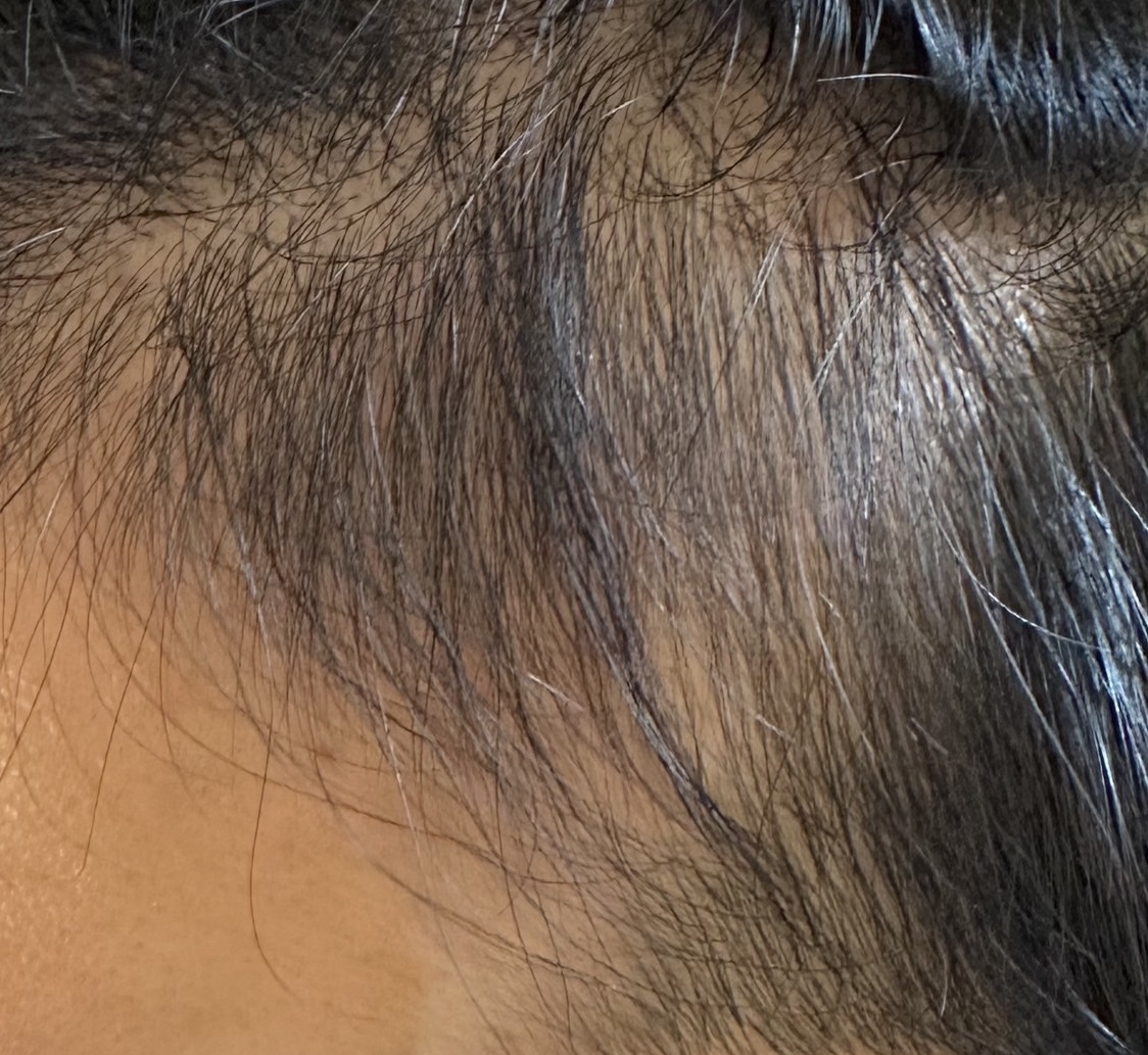 エクソソームPJ