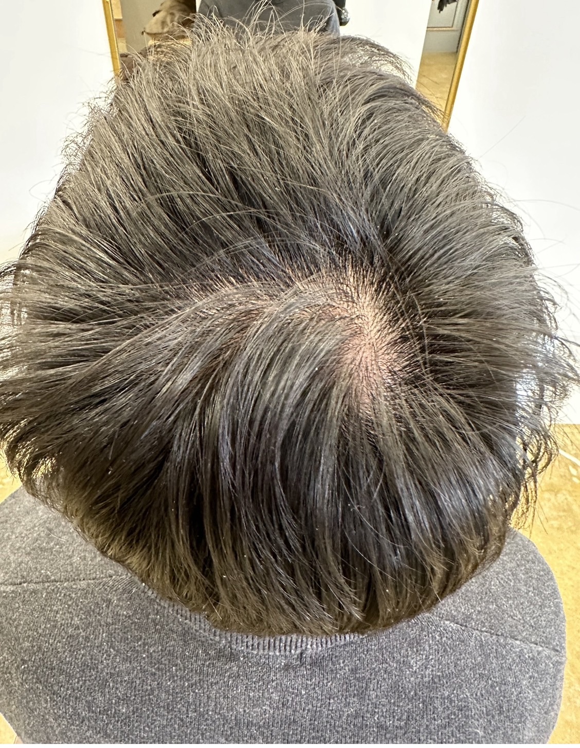 エクソソームPJ