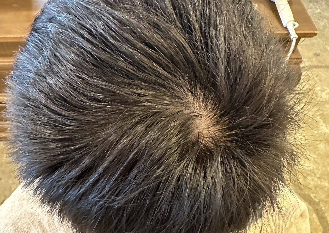 エクソソームPJ