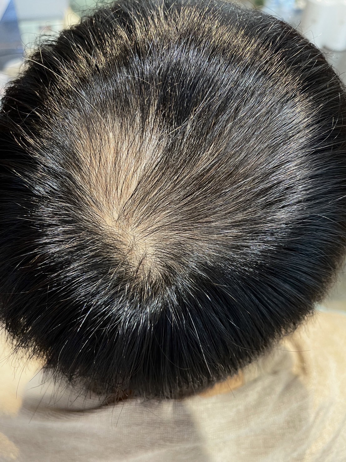 エクソソームPJ