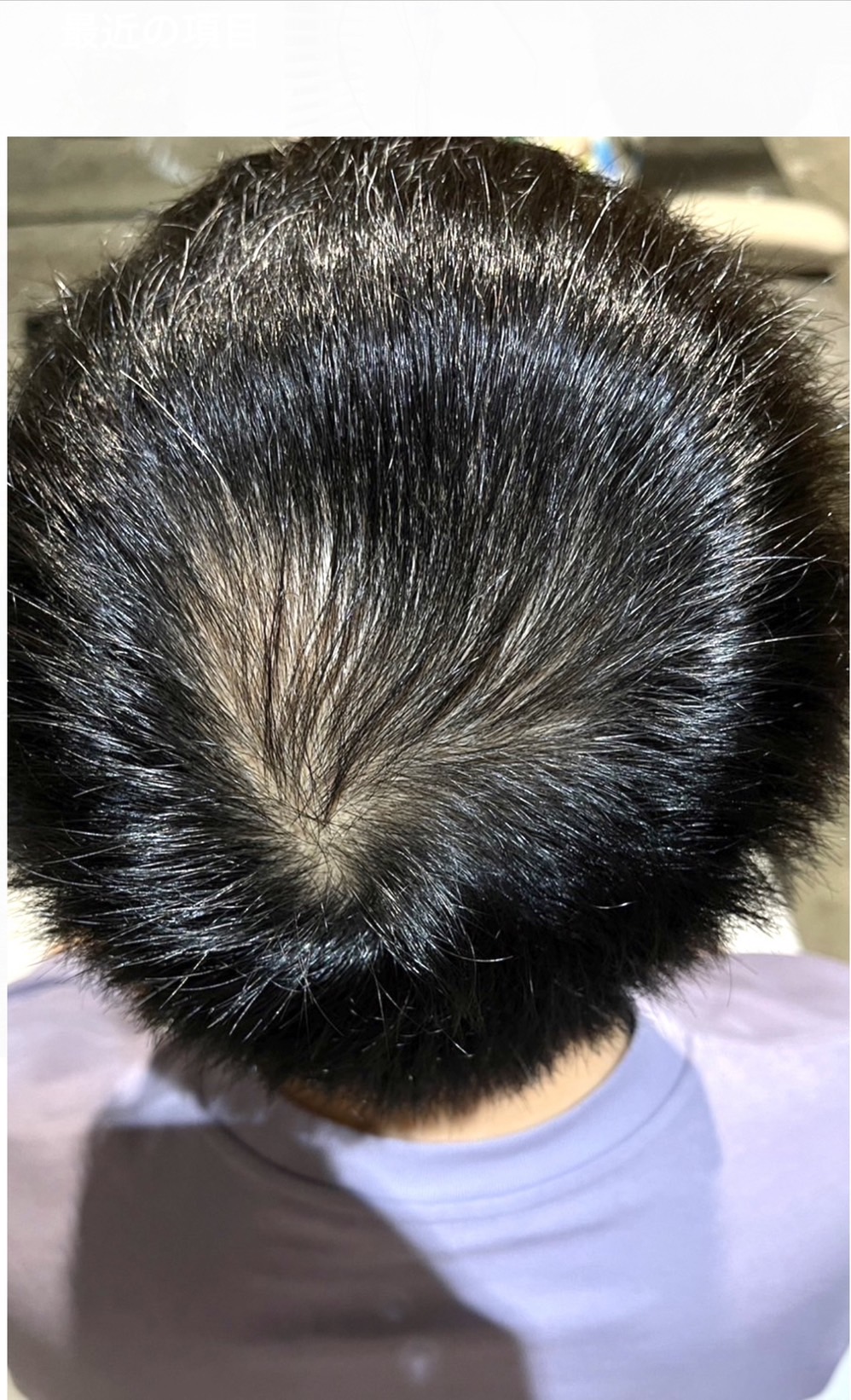 エクソソームPJ