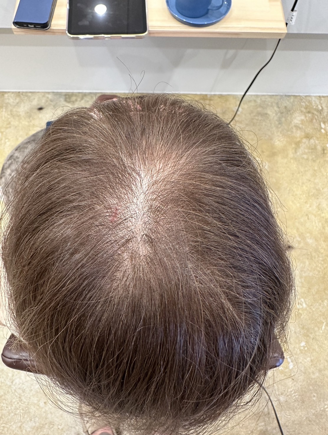 エクソソームPJ