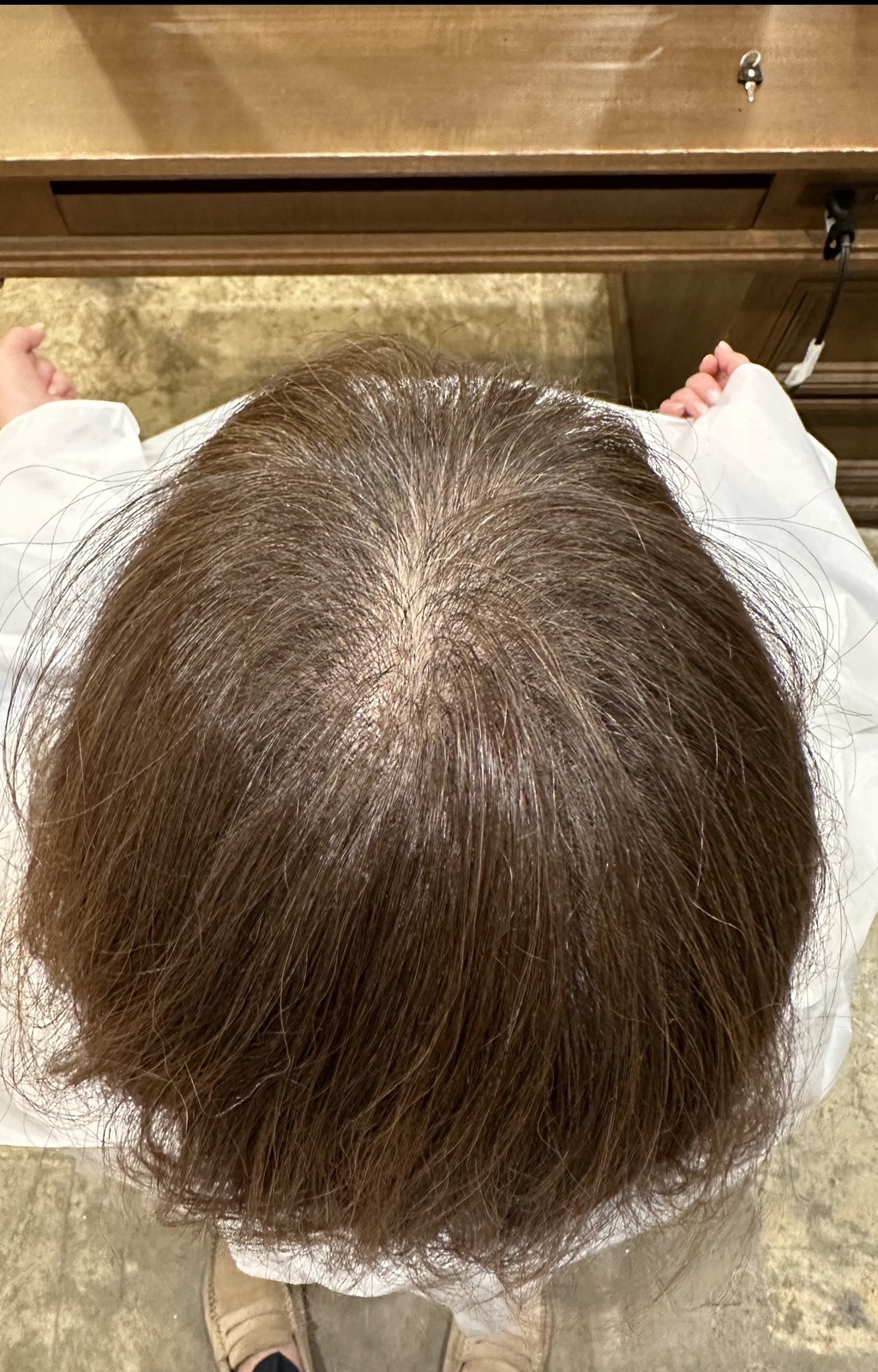 エクソソームPJ