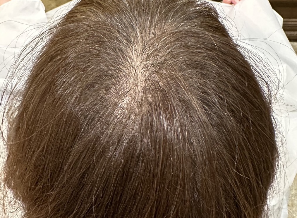 エクソソームPJ