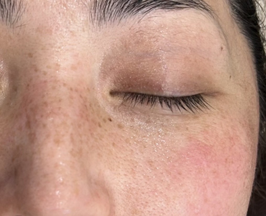 エクソソームPJ